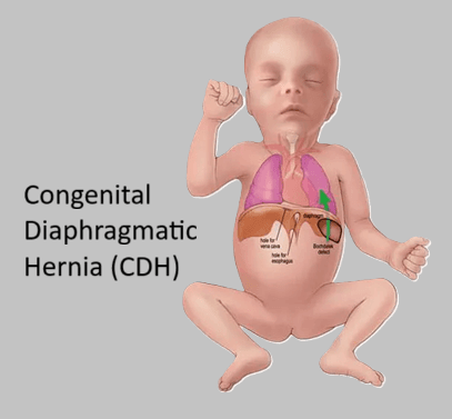 Cardiac Surgery (Pediatric)